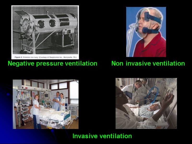 Negative pressure ventilation Non invasive ventilation Invasive ventilation